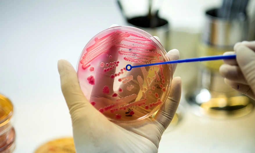 cesur- valladolid- GS-Anatomía-Patológica